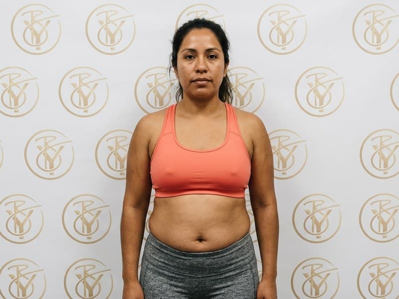 Lymphatic Drainage — before
