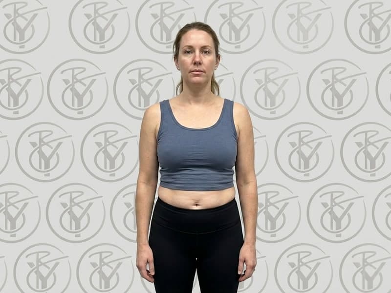 Ultrasonic Cavitation — before
