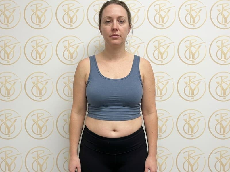 Ultrasonic Cavitation — before