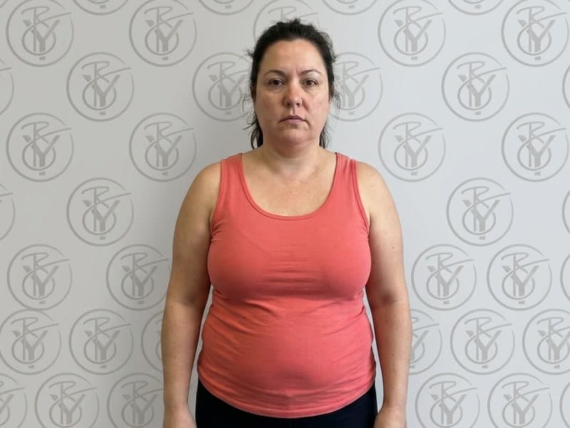 Weight Management — before