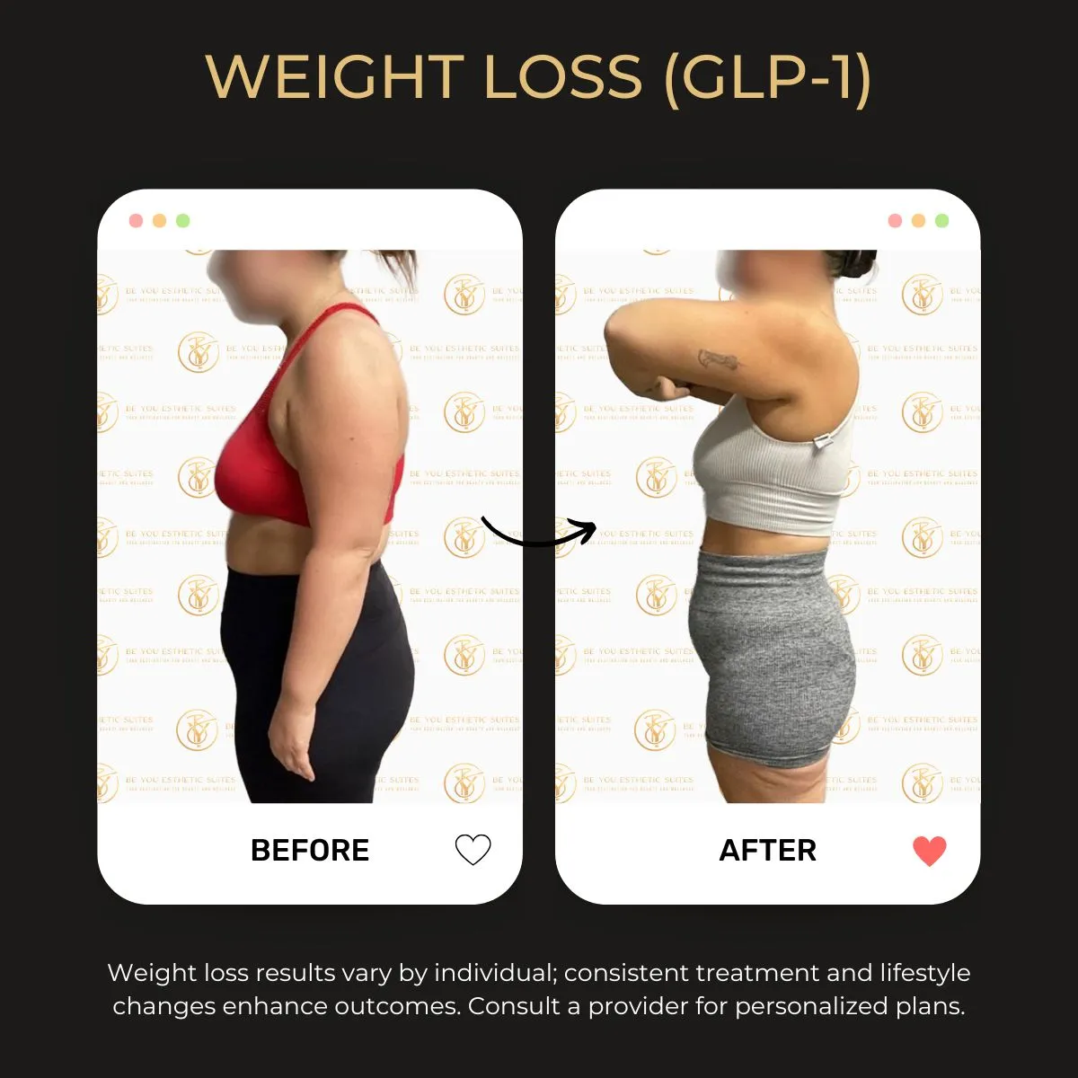 Weight loss program before and after — Be You Esthetic Suites.
