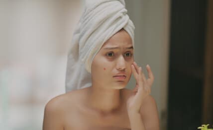 Dullness and uneven skin — microdermabrasion.