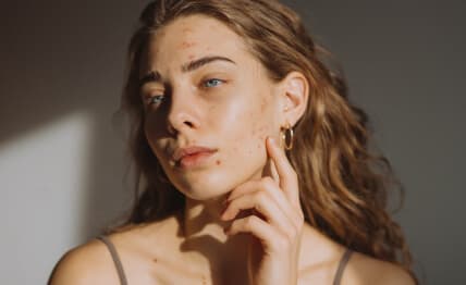 Acne scars or sun damage — microdermabrasion.