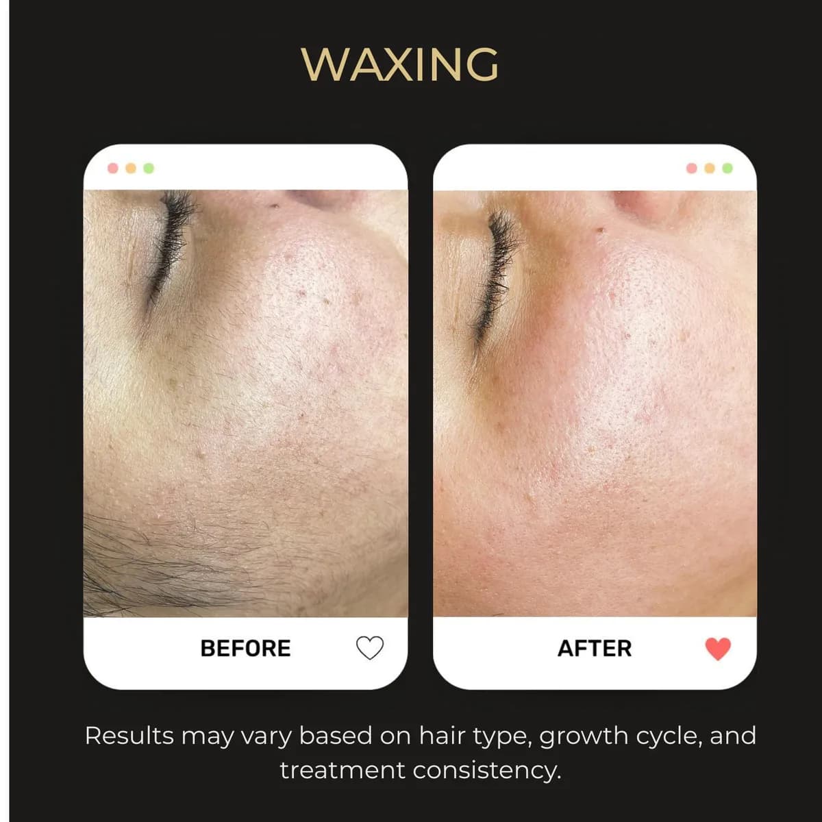 Before and after waxing at Be You Esthetic Suites.