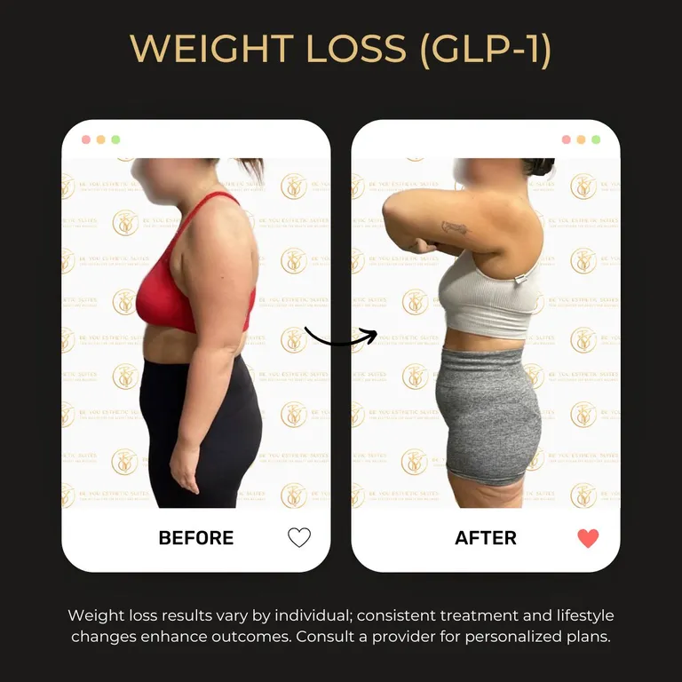 Weight loss before/after 1.