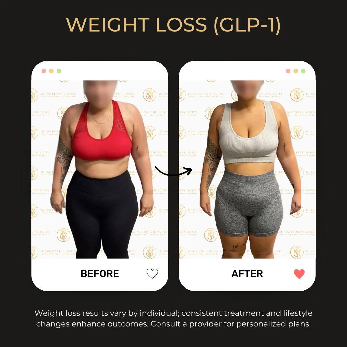 Weight loss before/after 2.