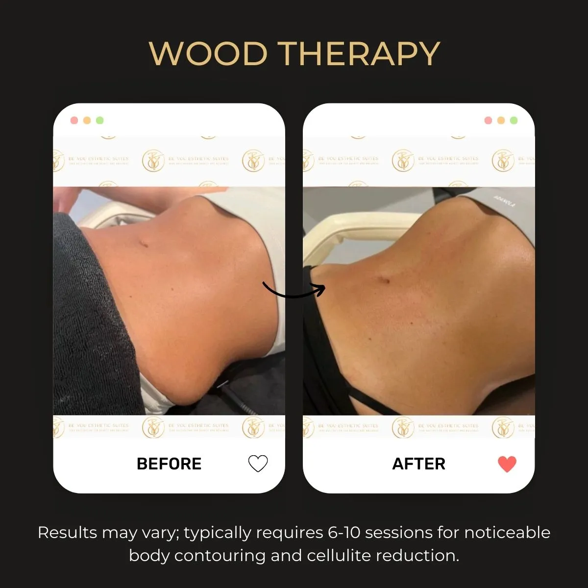 Wood therapy before/after example 2.