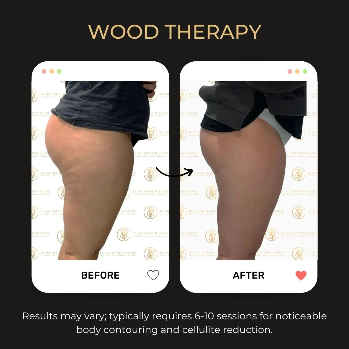 Wood therapy before/after example 1.