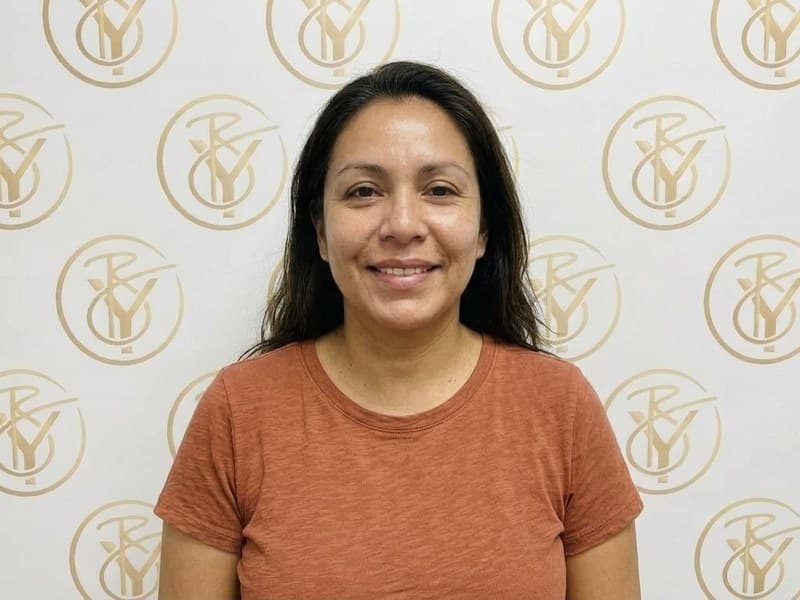 Chemical Peel — after