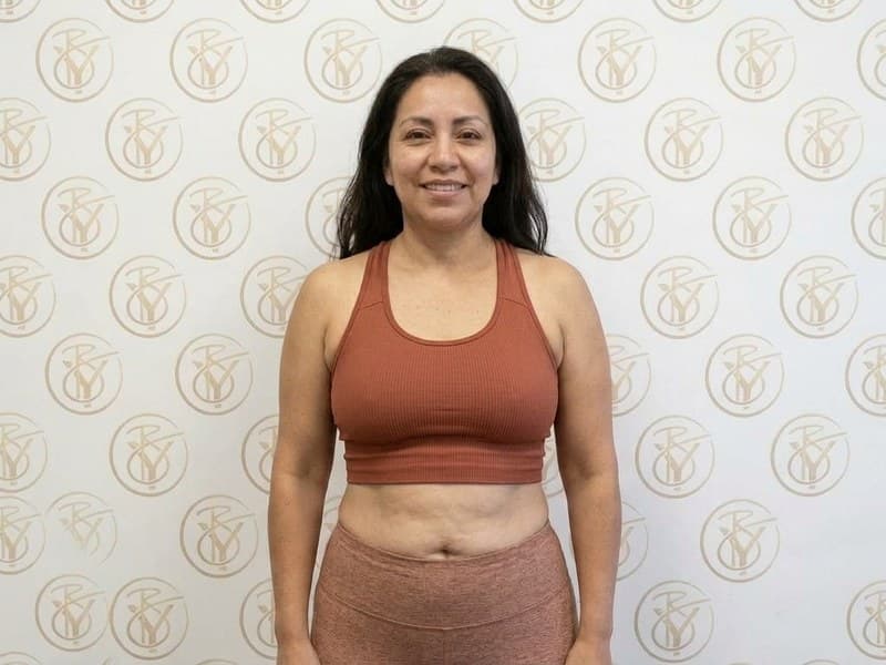 Ultrasonic Cavitation — after