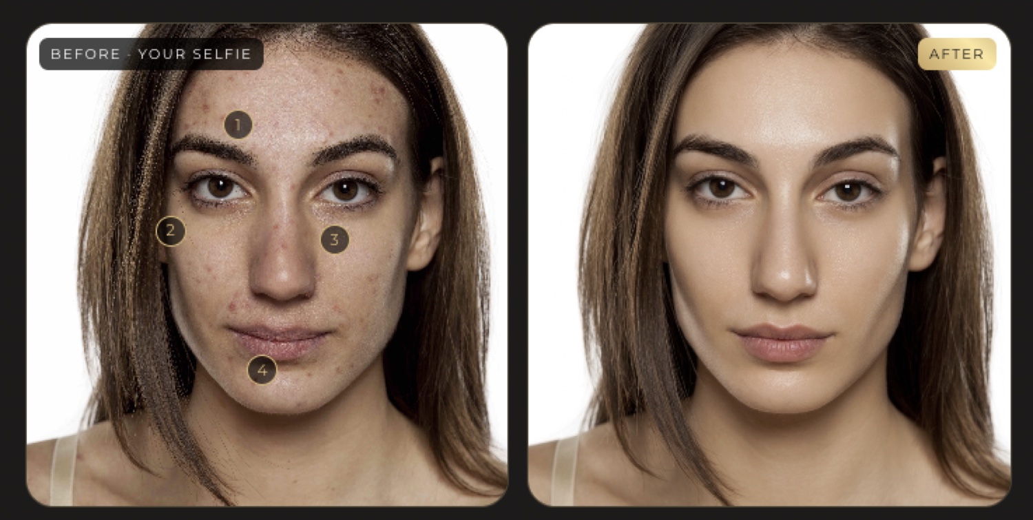 Example skin analysis: a before selfie with four visible concerns numbered, beside an AI illustrative preview